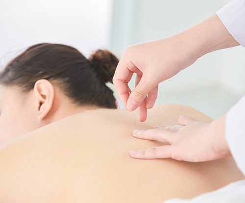 Acupuncture for Stress & Nervous System Balance Acupuncture for Stress & Nervous System Balance