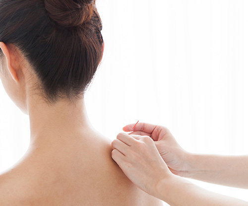 Acupuncture for Neck, Shoulder & Back Pain Acupuncture for Neck, Shoulder & Back Pain